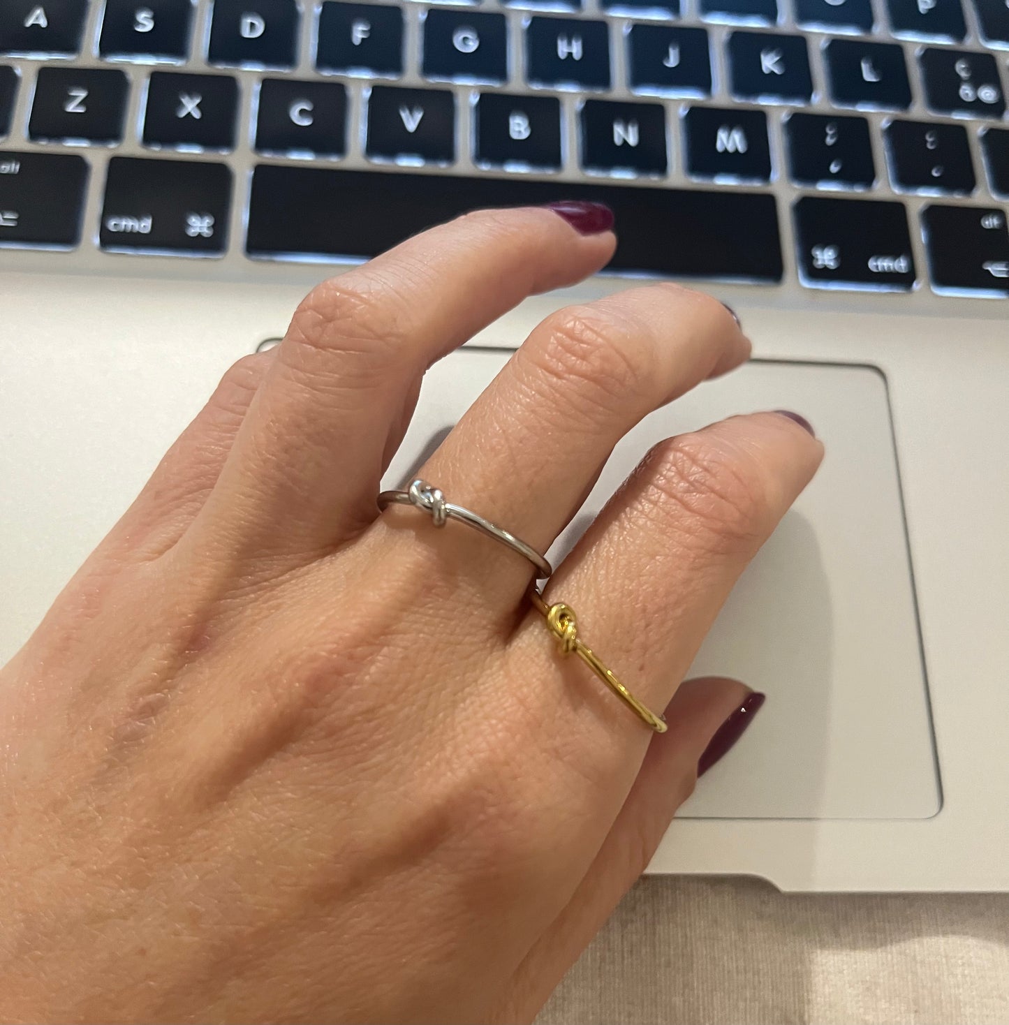 Anello Nodo
